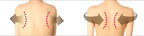 五十肩の場合の肩甲骨の位置。正常な場合の肩甲骨の位置